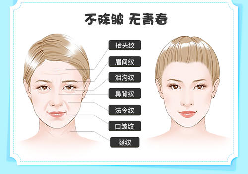 肉毒素除皺的副作用有哪些