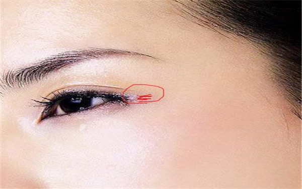 臉部色素斑會(huì)轉(zhuǎn)變?yōu)楹谏亓雎? /></p><br /><p style=