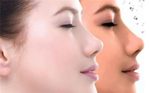 如何能快速消除臉上的斑點(diǎn)花費(fèi)大致多少錢