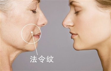 幫你消除色斑的幾招好方式