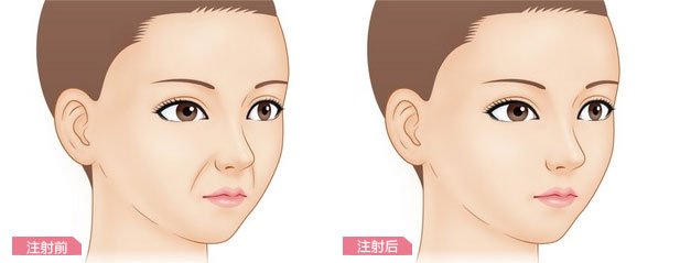 如何美白祛斑,激光祛斑多少錢(激光去斑一般多少錢？怎么樣美白祛斑？)