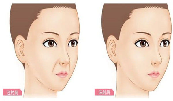 蘇州黑臉娃娃美容手術(shù)哪里好價格是多少