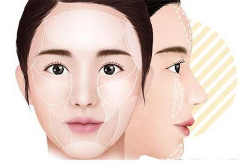 做去掉面部皺紋多久恢復(fù)