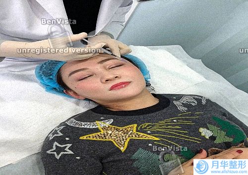 激光祛斑后可以吃什么水果和蔬菜(激光祛斑后可以吃什么菜利用修復(fù))