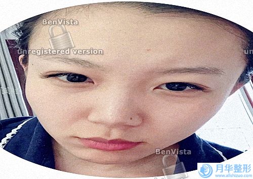 西南醫(yī)院祛疤掛什么科