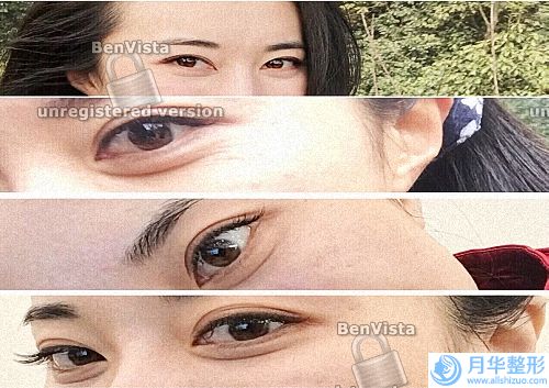 e光美容祛斑的價(jià)格(e光祛斑的價(jià)格)