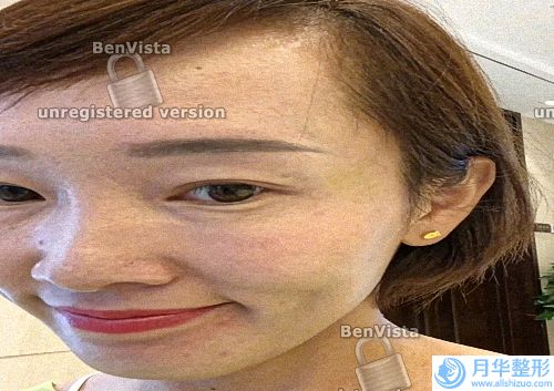 40歲女臉上長(zhǎng)斑(長(zhǎng)斑怎么清除)