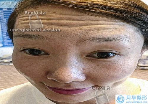臉上長斑是怎么樣的(臉上長斑變黃是什么原因)