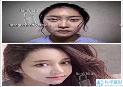 臉上有斑是什么原因造成(臉上長斑怎么化妝比較安全有效呢)