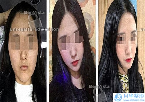 臉上為什么會(huì)長黃褐斑（為啥臉上會(huì)出現(xiàn)黃褐斑）