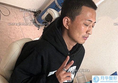 產(chǎn)后黃褐斑怎么去除效果好(產(chǎn)后臉上有黃褐斑怎么辦)