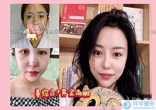 2022年鄭州市植發(fā)醫(yī)院十大榜單發(fā)布！均受到當(dāng)?shù)厝说臒崃覛g迎
