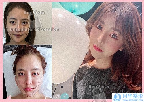 青島吸脂top10的整形醫(yī)院名單出爐！青島吸脂十佳整形醫(yī)院有哪些！看看誰位居榜首！