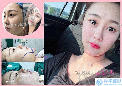 浙江自體脂肪填充整形醫(yī)院排名前三名單展示！江東薇琳、曙光醫(yī)療、時光醫(yī)療等憑實力入圍！