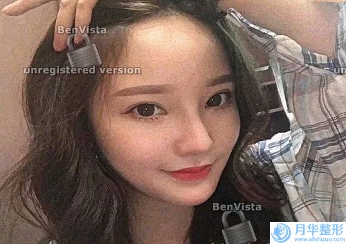 有一些女性呢，就是腰腹部比較肥胖的(聽(tīng)說(shuō)做完點(diǎn)陣激光以后會(huì)結(jié)痂呀，那這樣的話會(huì)破壞我們的皮膚角質(zhì)層啊)
