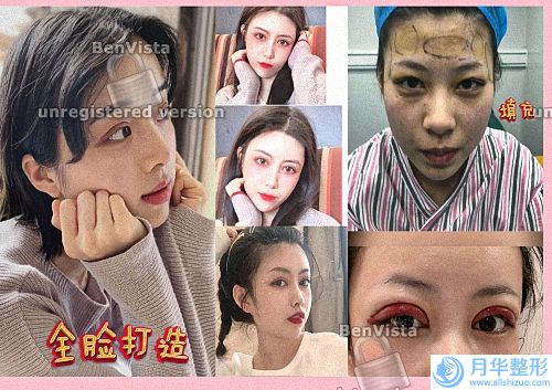 【排名】2022成都眼部修復(fù)十大醫(yī)生,邵眼部修復(fù)輝怎么樣
