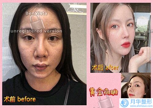 北京做熱瑪吉正規(guī)醫(yī)院排名榜權威盤點_歐揚、華韓名次上線.