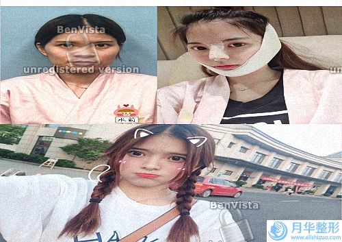 國內(nèi)面部脂肪填充醫(yī)院排名榜top10盤點_專家：趕緊收藏起來.
