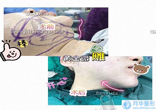 國內(nèi)熱瑪吉權(quán)威授權(quán)醫(yī)院排名前十！美萊、薇琳等各大城市都有！.