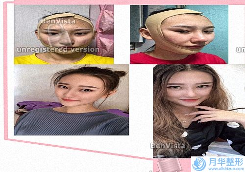 杭州雙眼皮較好醫(yī)院排名前七強公示_時光、清鍇沖上熱搜