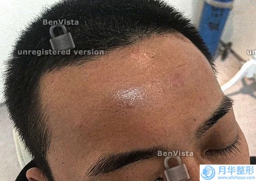 上海九院疤痕專家排名上海九院疤痕專家排名入圍上榜