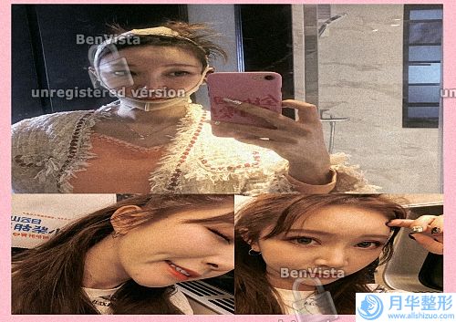 蘇州雙眼皮修復醫(yī)生排行榜六強更新_陳光、趙天蘭口碑亮了.
