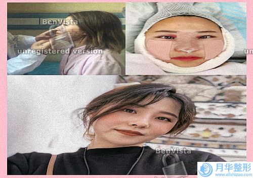 上海吸脂手術(shù)醫(yī)院排名前五！玫瑰、伯思立、德琳等供參考！看看哪個(gè)技術(shù)好？.
