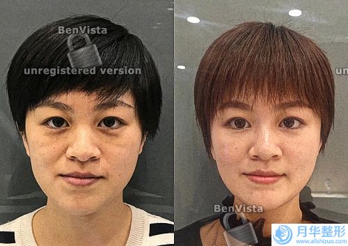 哈爾濱公立整形醫(yī)院排名榜！哈醫(yī)大一院、四院等入圍_可查熱瑪吉案例和價格.