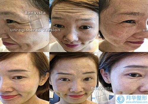寧波三甲整形醫(yī)院排名榜！同享口碑實(shí)力、拉皮除皺案例、價(jià)格表詳情！.