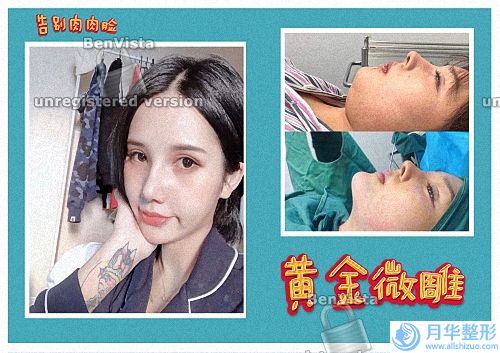 潮州熱瑪吉官方授權(quán)醫(yī)院名單介紹,潮州博蘭雅激光整形美容醫(yī)院入圍上榜