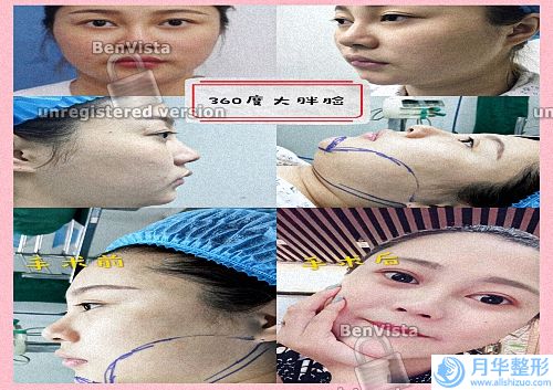 漳州整形醫(yī)院排名前十口碑一一介紹,漳州漳州第一醫(yī)院整形美容科入圍上榜