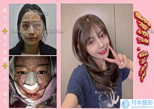 杭州整形醫(yī)院排名前三名次更新，公立三甲排行榜pk、吸脂案例、價(jià)格同步!.