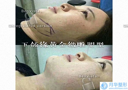 嘉興做熱瑪吉授權(quán)醫(yī)院排名公布！來瞧瞧上榜的五家醫(yī)院哪家果口碑好~.