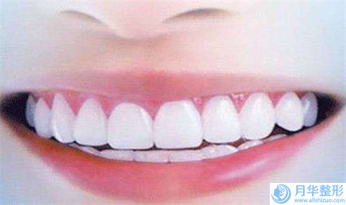 烏蘭察布市深藍(lán)腹部溶脂醫(yī)生點(diǎn)評-樸圣勛醫(yī)生可預(yù)約啦