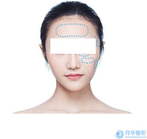 湖州市唇裂的價格表曝光_全新收費標(biāo)準展示-湖州市唇裂的價格行情