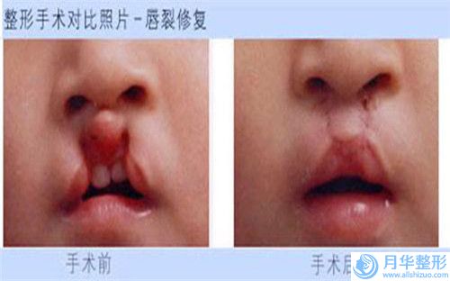 南昌市伊維蘭注射隆下巴醫(yī)院口碑排行榜當?shù)乜诒茫喜袢葆t(yī)療美容診所這份名單看了不虧）