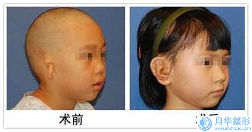 翟曉濤整形醫(yī)生-雙遼愛美匯醫(yī)療美容診所翟曉濤醫(yī)生矯正你大爺陷榜首預(yù)定~