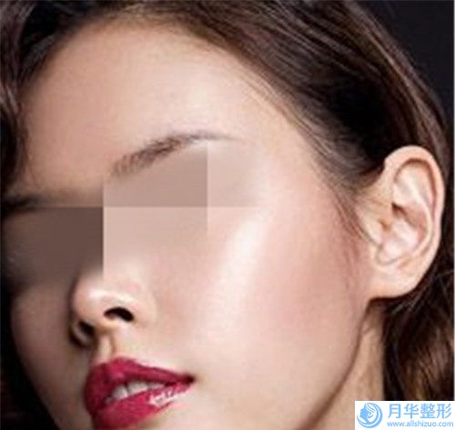 珠海市乳頭縮小術(shù)手術(shù)費(fèi)貴不貴價(jià)格表2023-珠海市乳頭縮小術(shù)手術(shù)需要費(fèi)用多不多