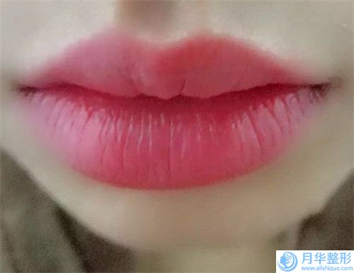 宜春市墊下巴瘦臉2023優(yōu)惠價(jià)格詳情一覽-宜春市墊下巴瘦臉價(jià)格行情