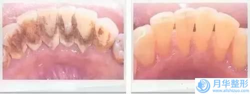 贛州市激光治療皮脂腺痣醫(yī)生排名前十佳名單已確定-張恒醫(yī)生獨(dú)有技術(shù)_效果驚艷眾人