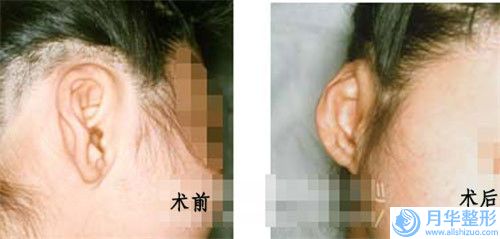 衡水市乳房修復(fù)術(shù)新價(jià)格表(2023年5月均價(jià)為：33891元）