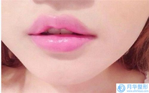 石家莊市安法硅膠墊下巴醫(yī)院口碑排行前十位網(wǎng)友良心推薦（石家莊市安法硅膠墊下巴整形醫(yī)院）
