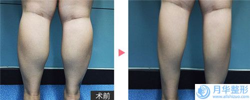 周口市韓式顴骨整形醫(yī)生口碑排行榜top10強(qiáng)名單匯總-周口市孫培厚整形醫(yī)生