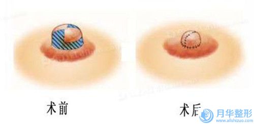?？谑胁Ｄ蛩嶙⑸涮畛漕~頭醫(yī)院排名十強(qiáng)名單給你-?？谑胁Ｄ蛩嶙⑸涮畛漕~頭整形醫(yī)院