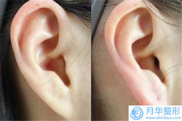 江蘇省胸部下垂改善醫(yī)院排行榜前十佳綜合名單盤(pán)點(diǎn)-常州天醫(yī)療美容門(mén)診部個(gè)個(gè)特色鮮明