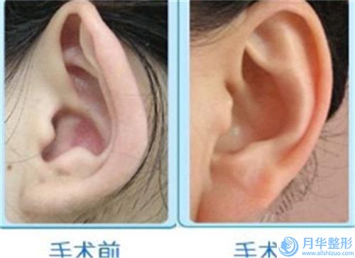 關(guān)世超整形醫(yī)生-上饒市卓真醫(yī)療美容關(guān)世超醫(yī)生乳房矯正論技術(shù)