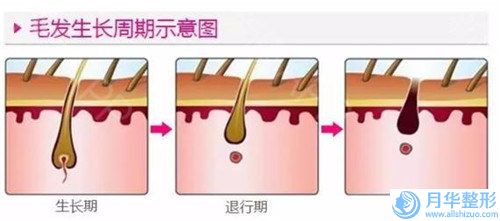 常州黑臉娃娃治療毛孔粗大整形手術(shù)價格怎么樣呢