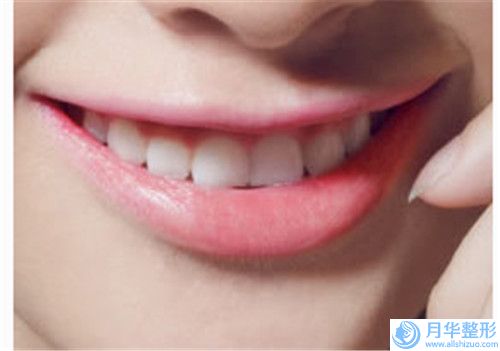 山西省頰脂墊整形收費(fèi)標(biāo)準(zhǔn)-山西省頰脂墊整形要準(zhǔn)備多少錢