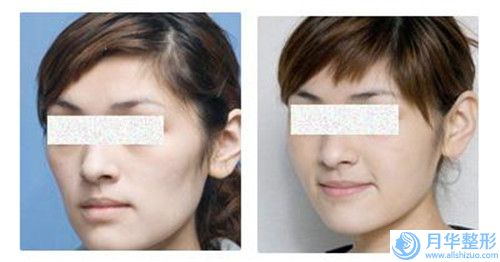 南平市做兔唇整形醫(yī)院口碑排名top10強收藏起來-南平致奈美醫(yī)療美容診所都有實力