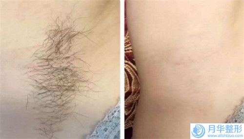 遂寧市瘦臉針溶脂美容醫(yī)院排名榜前十位強力推薦（遂寧雙華整形美容技術(shù)點評_資料一覽）